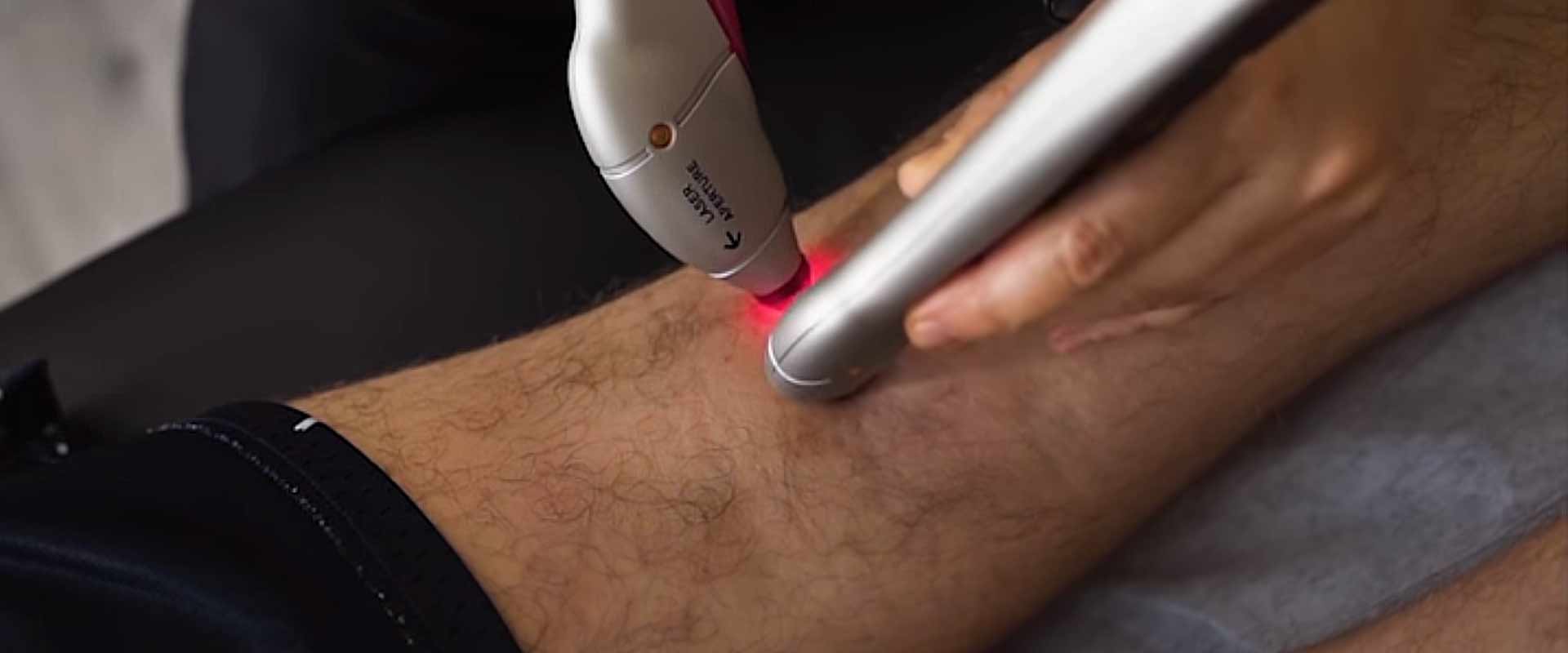 BioFlex Laser slide4